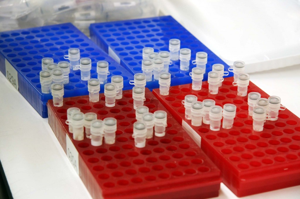 test tube vials in blue & red holders
