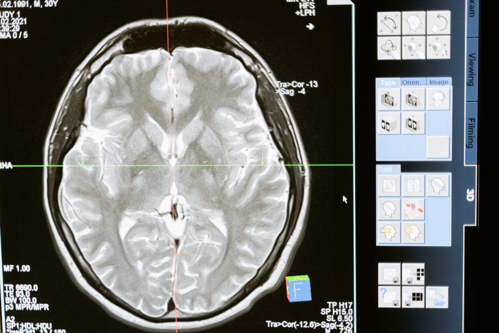 detailed brain scan